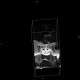 Aneurysm of internal carotid artery, left: CT - Computed tomography