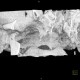 Arthrosis of temporomandibular joint, TMJ: CT - Computed tomography