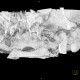 Arthrosis of temporomandibular joint, TMJ: CT - Computed tomography