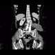 Abscess after diverticulitis, second CT: CT - Computed tomography