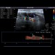 Inflammatory lymph node: US - Ultrasound