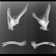 Radiological archeology: X-ray - Plain radiograph