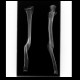Radiological archeology: X-ray - Plain radiograph