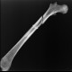 Radiological archeology: X-ray - Plain radiograph