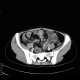 Crohn's disease of ileum, CT enterocysis, 2009: CT - Computed tomography