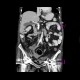 Chronic calcified pancreatitis: CT - Computed tomography