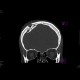 Depressive fracture of skull: CT - Computed tomography