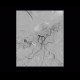 Diverticular bleeding, embolisation: AG - Angiography