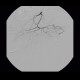 Bleeding into large bowel, embolisation: AG - Angiography