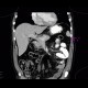 Variant of head of pancreas: CT - Computed tomography