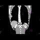 Ewing sarcoma of rib: CT - Computed tomography