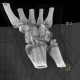 Fracture of scaphoid bone, dislocation of pisiform bone, abruption of lunate: CT - Computed tomography