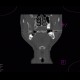 Follicular cyst: CT - Computed tomography