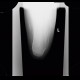 Fracture of calcaneus, atypical: X-ray - Plain radiograph