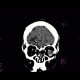 Hemocephalus, subarachonoid hemorrhage, subdural hematoma, brain contusion: CT - Computed tomography