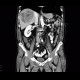 Hepatocellular carcinoma, HCC, gigantic: CT - Computed tomography