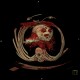 Constrictive pericarditis, VRT: CT - Computed tomography