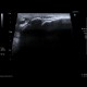 Calcification in patellar ligament, infrapatellar bursa: US - Ultrasound