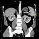 Renal carcinoma, small, detected on ultrasound, correlation of ultrasound and CT: CT - Computed tomography