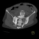 Fracture of pelvis, pubic bone, subluxation of sacrum: CT - Computed tomography