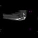 Osseous bridging of the left elbow: CT - Computed tomography
