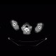 Malignant lymphoma, ultrasound of lymph nodes, correlation with CT and NM: CT - Computed tomography