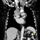 Mediastinal lymphadenopathy, malignant lymphoma, correlation: CT - Computed tomography