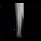 Multiple myeloma: X-ray - Plain radiograph