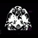 Occipital conus, brain edema, subarachnoid hemorrhage, pneumocephalus: CT - Computed tomography
