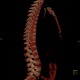 Unknown pathology of spine: CT - Computed tomography