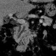Pancreas divisum on CT, mininum intensity projection, MinIP: CT - Computed tomography