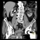 Parapelvic cysts of kidney, Paramo's syndrome: CT - Computed tomography
