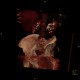 Parapelvic cysts of kidney, Paramo's syndrome, VRT: CT - Computed tomography