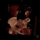 Parapelvic cysts of kidney, Paramo's syndrome, VRT: CT - Computed tomography