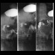 Stomach ulcer: RF - Fluoroscopy