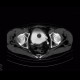 Trabecular hypertrophy of bladder, trabeculated bladder, pseudodiverticula: CT - Computed tomography