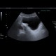 Trabecular hypertrophy of bladder wall: US - Ultrasound