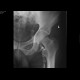 Phlebography: X-ray - Plain radiograph