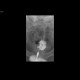 Urocystocutaneous fistula, fistulography: RF - Fluoroscopy