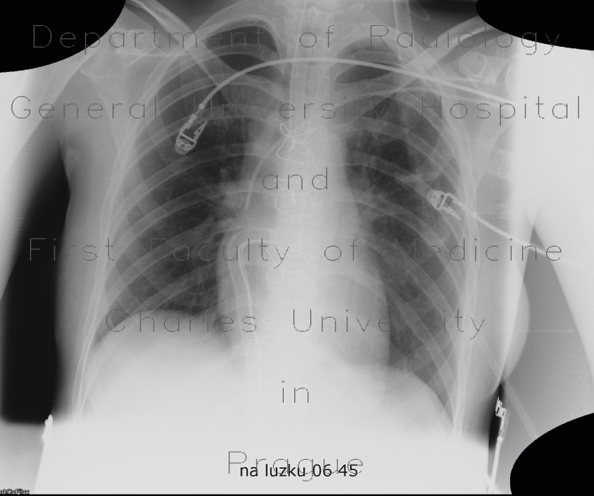 Circulatory assist device