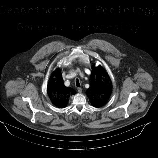 Radiology image - Detector malfunction: Abdomen, Thorax, Other: CT - Computed tomography
